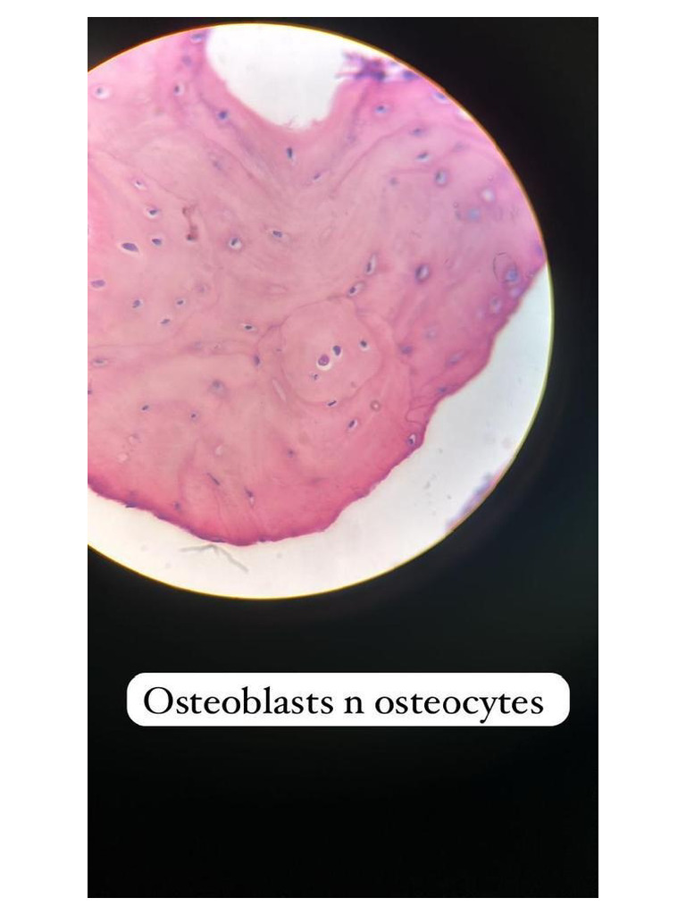 Dadh Slides | PDF