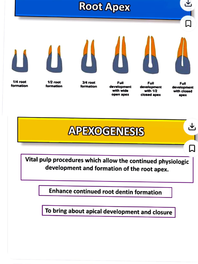 Apexogenesis and Apexification | PDF