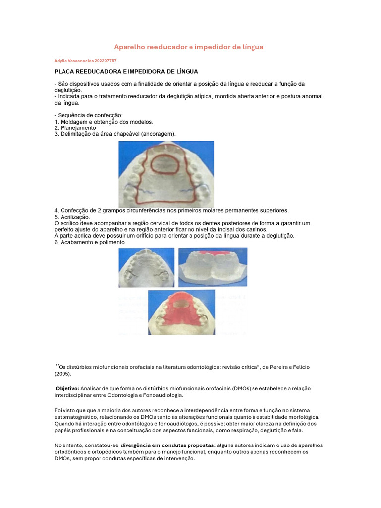 Aparelho Reeducador de Lingual - Adylla Vasconcelos | PDF