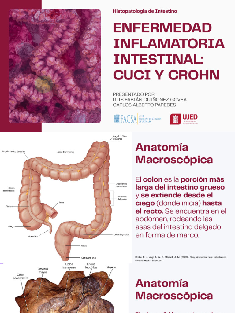 Histopatologia de Intestino, Gastroenterologúa | PDF | Colitis ulcerosa ...