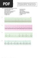 ACLS Rhythms Cheat Sheet