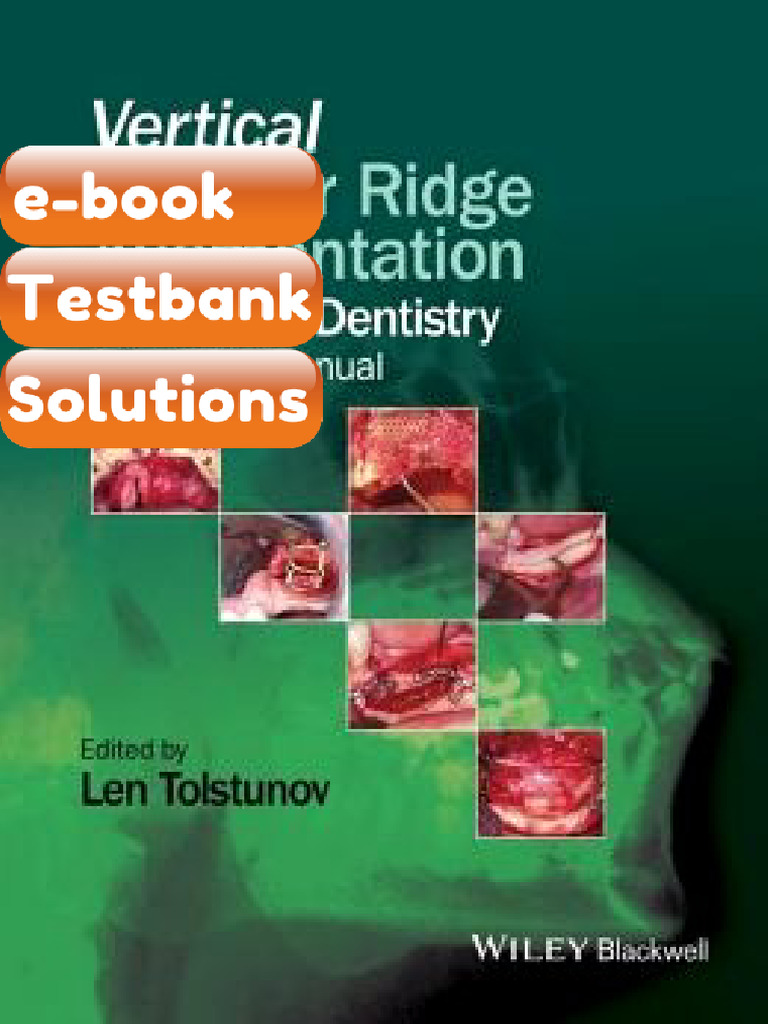 Testbank for Vertical Alveolar Ridge Augmentation in Implant Dentistry ...
