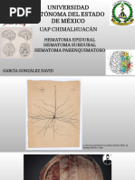 Tipos de Hematomas Cerebrales | PDF | Sistema nervioso | Especialidades ...