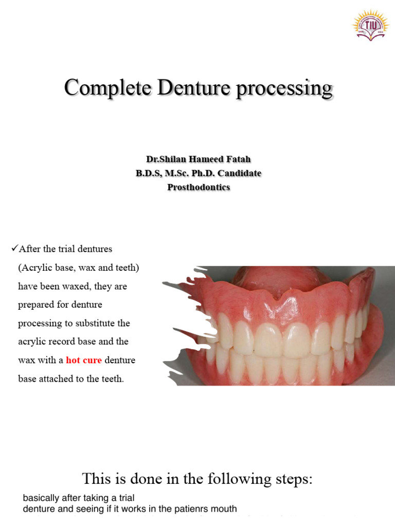 Processing of Complete Denture | PDF | Poly(Methyl Methacrylate) | Dentures