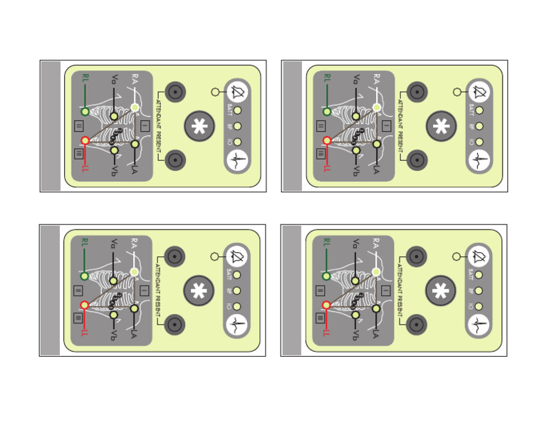 Holter Monitor | PDF