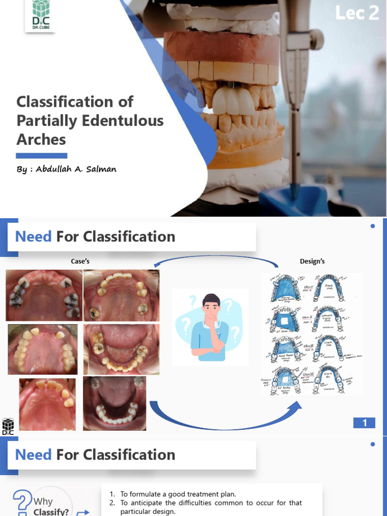 Pros3 Lec.2 Classification | PDF | Dentures | Dentistry Branches