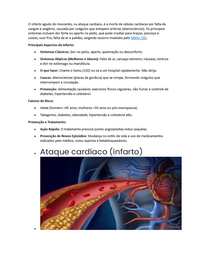 O Infarto Agudo Do Miocárdio | PDF | Infarto do Miocárdio | Aterosclerose