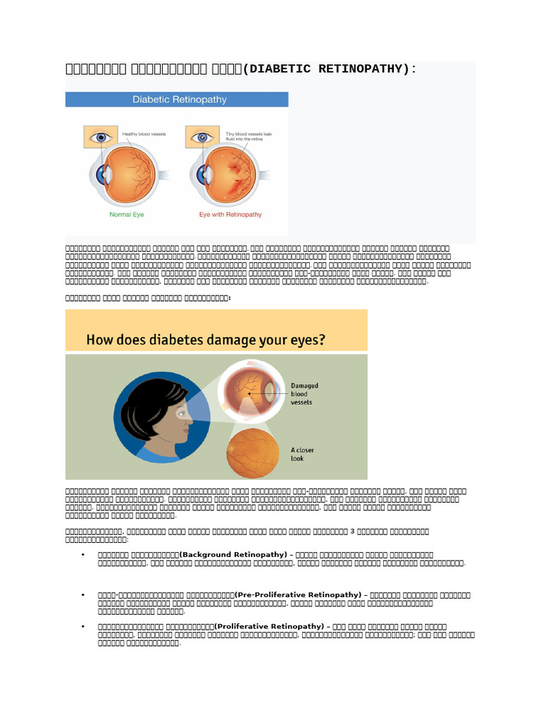Diabetic Retinopathy | PDF