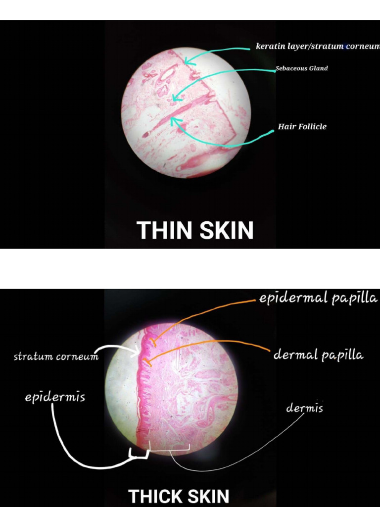 Histo 1 | PDF
