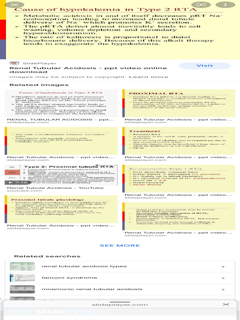 Why Hypokalemia Happens in Type 2 Rta - Google Search | PDF