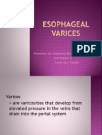 Esophageal Varices