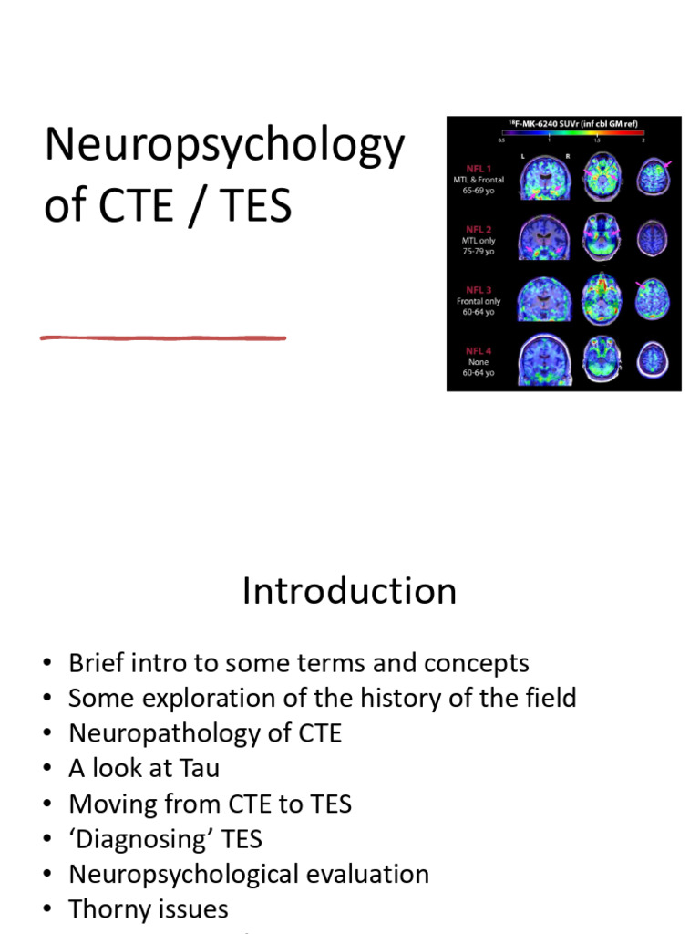 Neuropsychology - CTE - TES - Lecture 18 - 09 - 2025 | PDF | Chronic ...