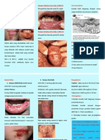 Brosur Herpes Simpleks