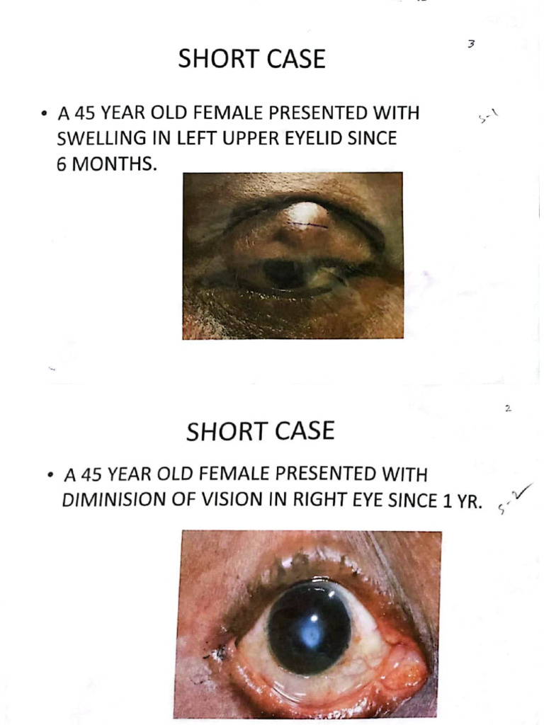 Opthal Short Case (1) | PDF