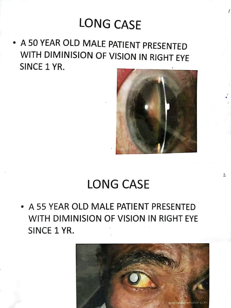 Opthal Long Case (1) | PDF