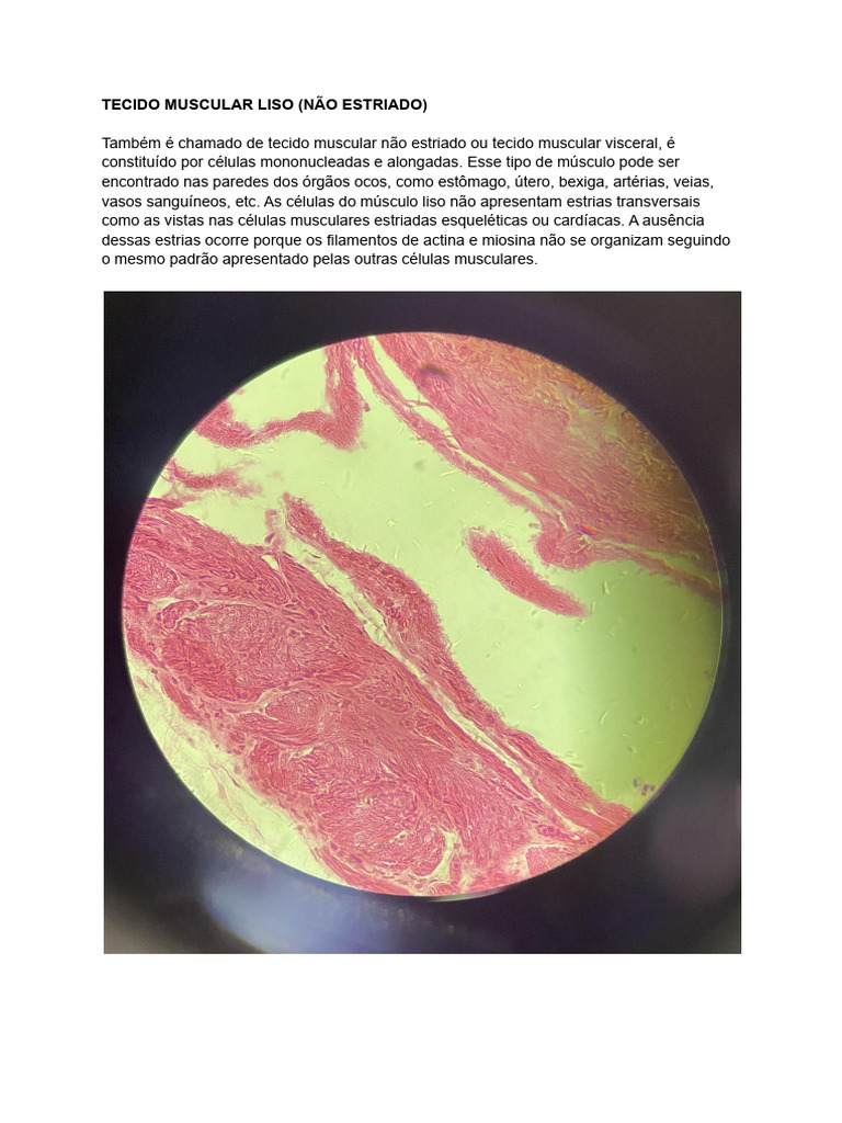 Tecido Muscular | PDF