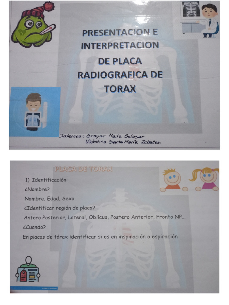 Interpretación de RX | PDF
