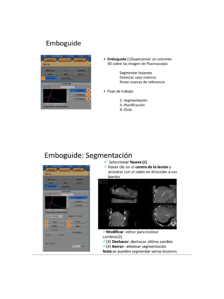 Emboguide Azurion | PDF