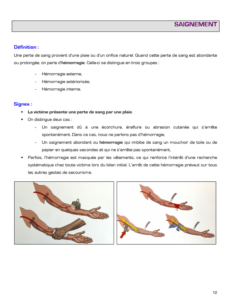 8 - Saignement | PDF | Saignement | Plaie