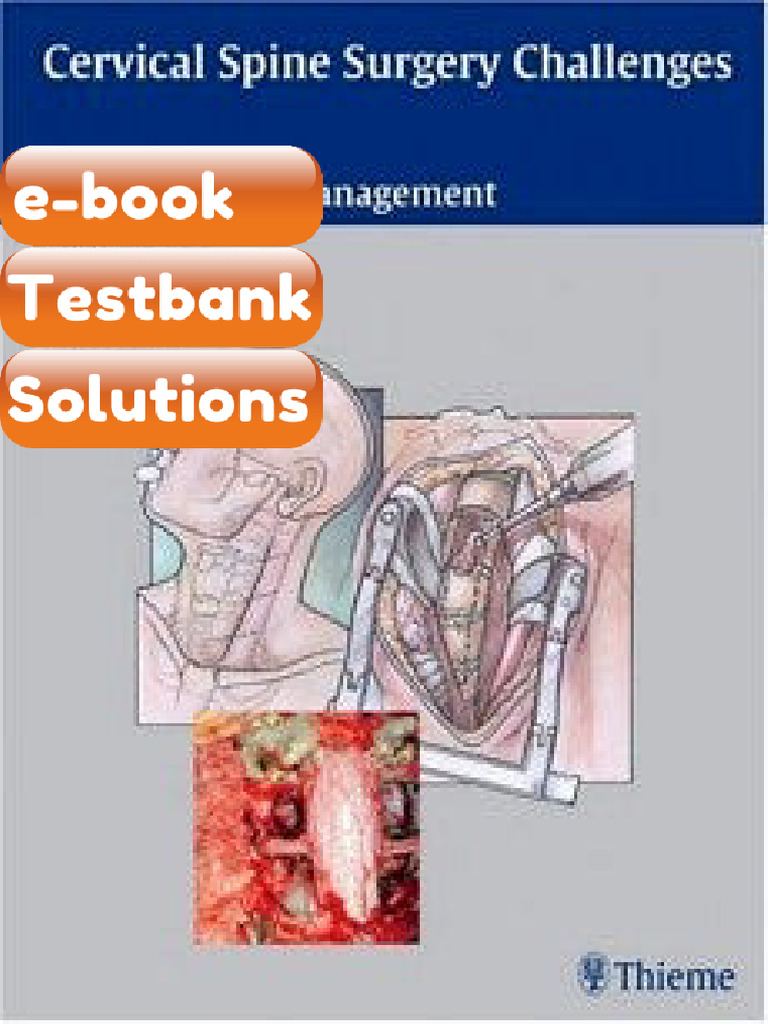 Testbank Cervical Spine Surgery Challenges Diagnosis and Management ...