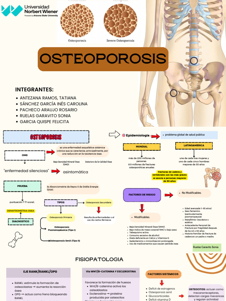 Osteoporosis | PDF | Osteoporosis | Hueso