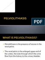 PELVIOLITHIASIS