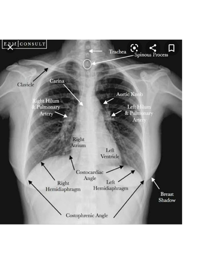 X Rays Radio | PDF