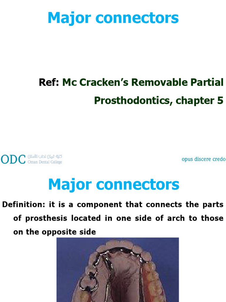 Major Connectors | PDF | Mouth | Dentistry Branches