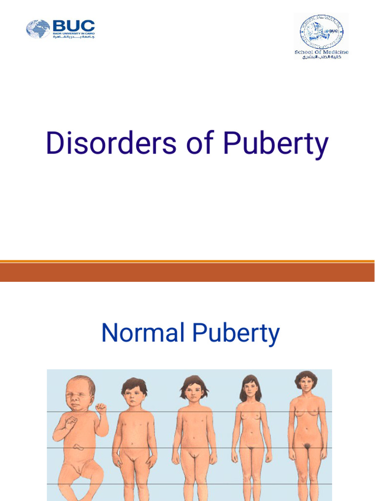 Disorders of Puberty, Hirsutism and Pre-menstrual Disorders(2) | PDF ...