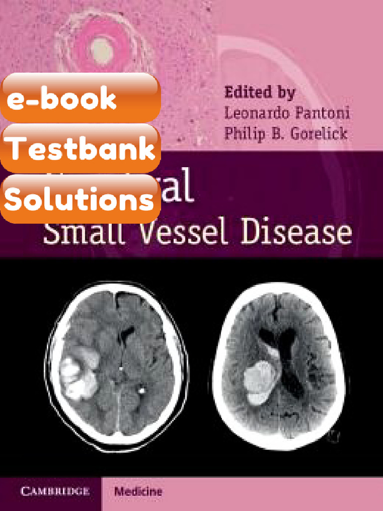 Testbank - Cerebral Small Vessel Disease | PDF | Neurology | Human ...