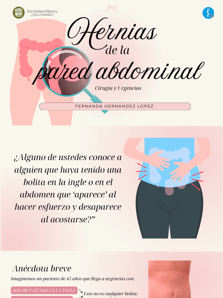 Hernias de La Pared Abdominal | PDF