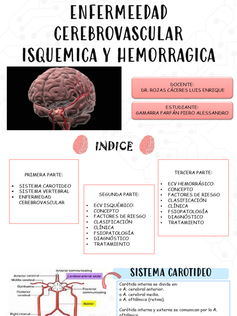 Acv Isquemico y Hemorragico | PDF | Carrera | Isquemia