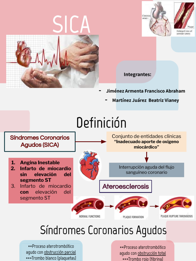 SICA | PDF | Infarto de miocardio | Especialidades Medicas