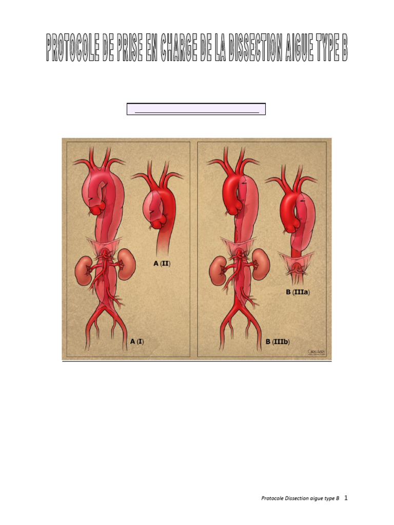 Protocole Dissection Aortique Type B | PDF | Aorte | Spécialités médicales