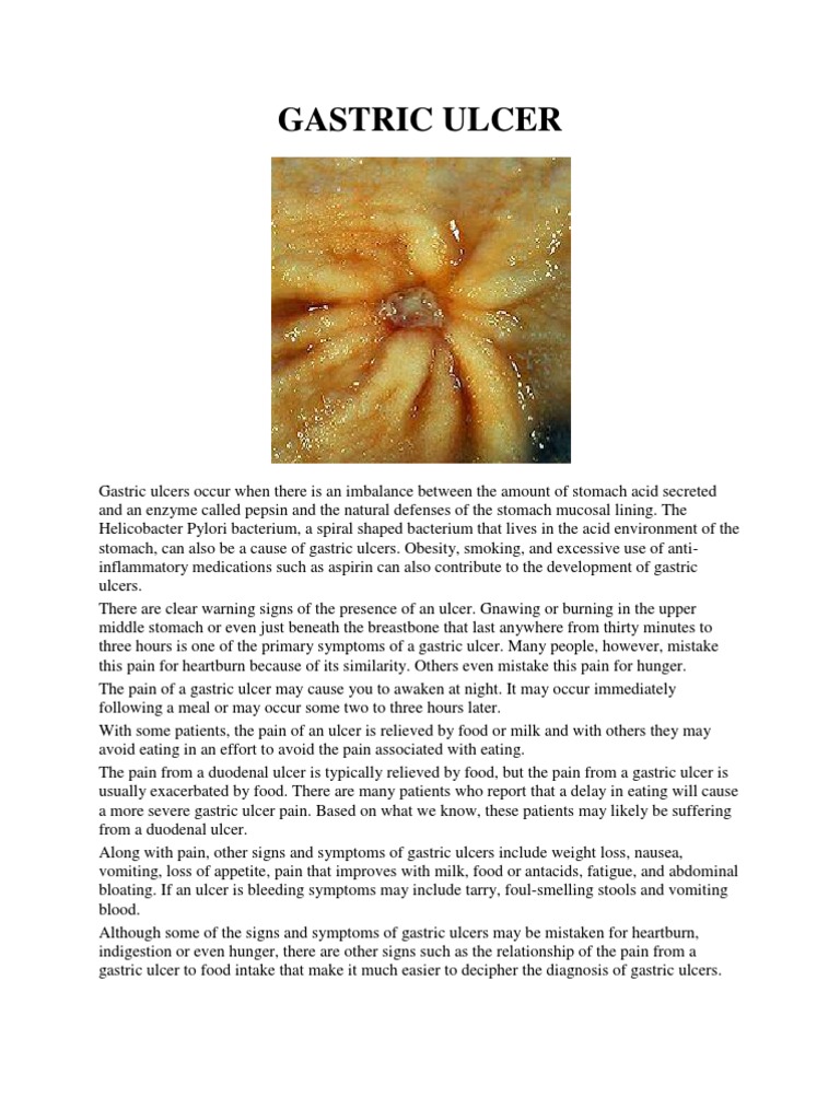 Gastric Ulcer Peptic Ulcer Tobacco Smoking