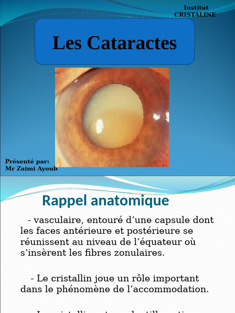 La Cataracte | PDF | Cataracte | Sens (physiologie)