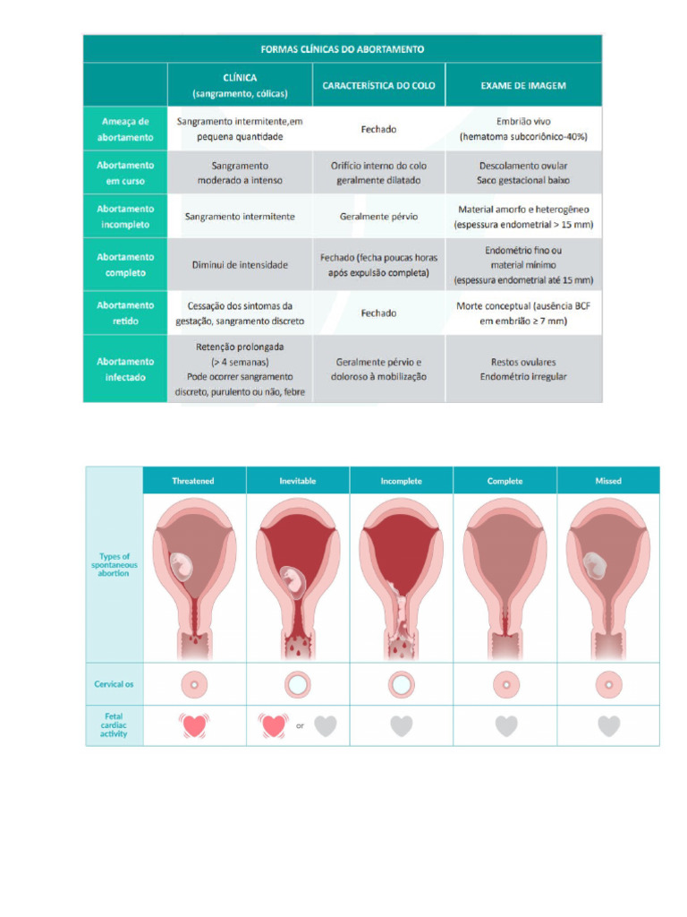 ABORTO | PDF | Aborto | Gravidez