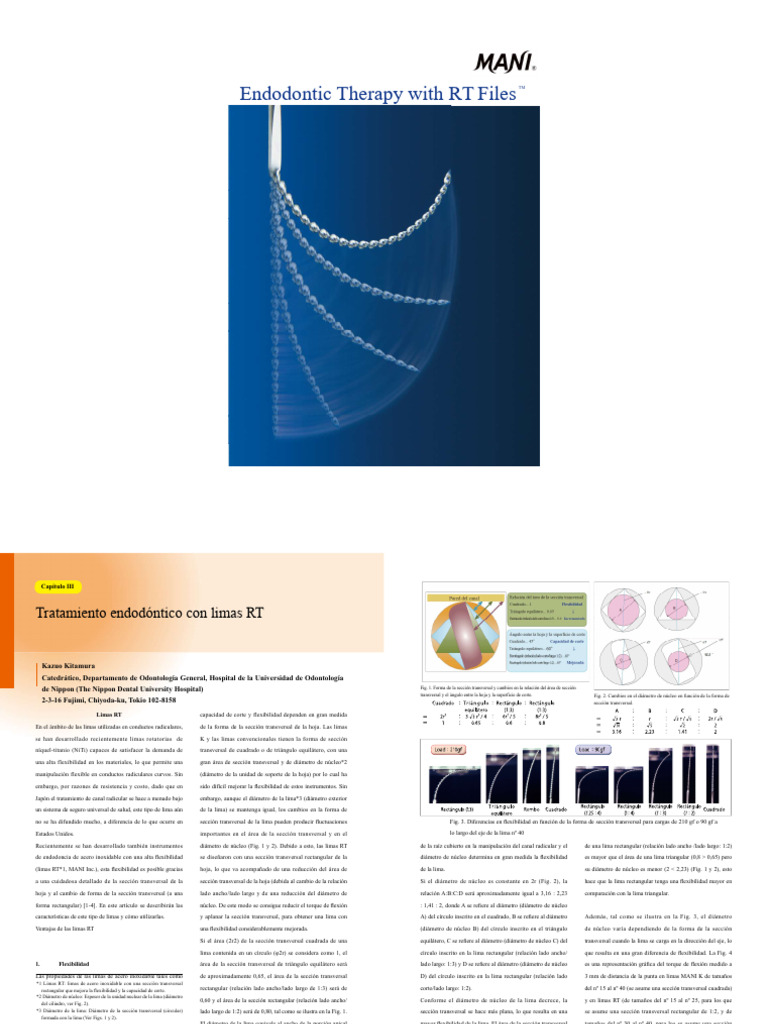 Endodontic Therapy With RT Files_Spanish (1) | PDF