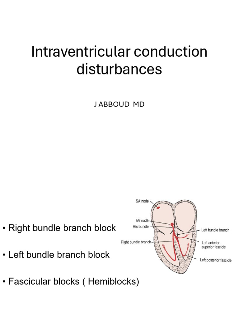 Intraventricular Conduction Disturbances | PDF | Electrocardiography ...