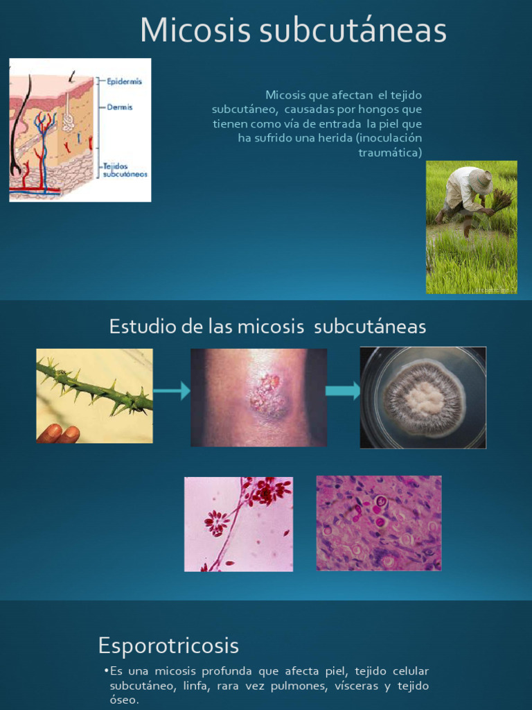 Micosis Subcut Neas | PDF | Especialidades Medicas | Enfermedades y ...