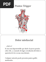 Puntos Trigger MioFaciales