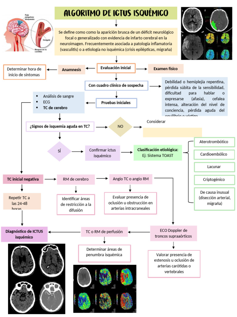 Algoritmo Ictus Isquemico | PDF | Carrera | Isquemia