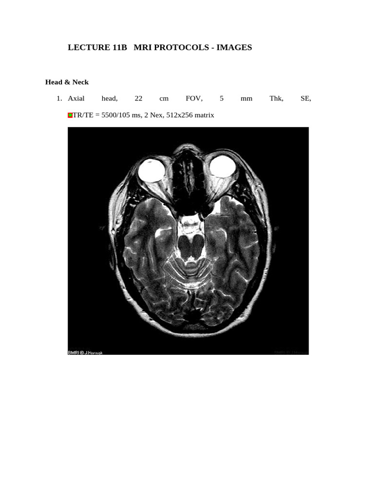 Lecture 11 B Mri Protocols - Images | PDF | Chess Theory | Chess
