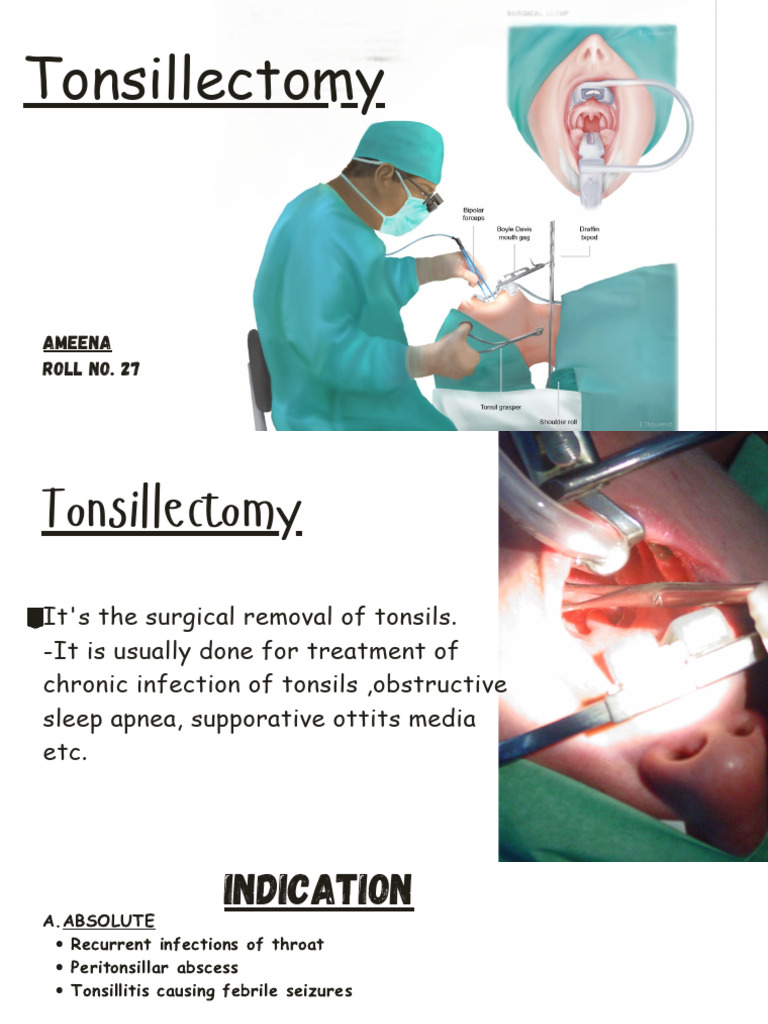 Tonsillectomy 20260206 100802 0000 | PDF | Medicine | Diseases And ...