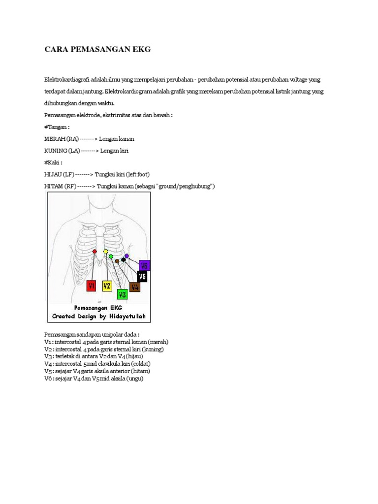  Cara Pemasangan Ekg 