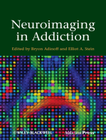 Neuroimaging in Addiction