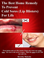 The Best Home Remedy To Prevent Cold Sores (Lip Blisters) For Life