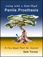 Living with the Semi-Rigid Penile Prosthesis