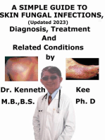 A Simple Guide to Skin Fungal Infections, (Updated 2023) Diagnosis, Treatment and Related Conditions