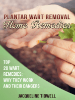 Plantar Wart Removal Home Remedies